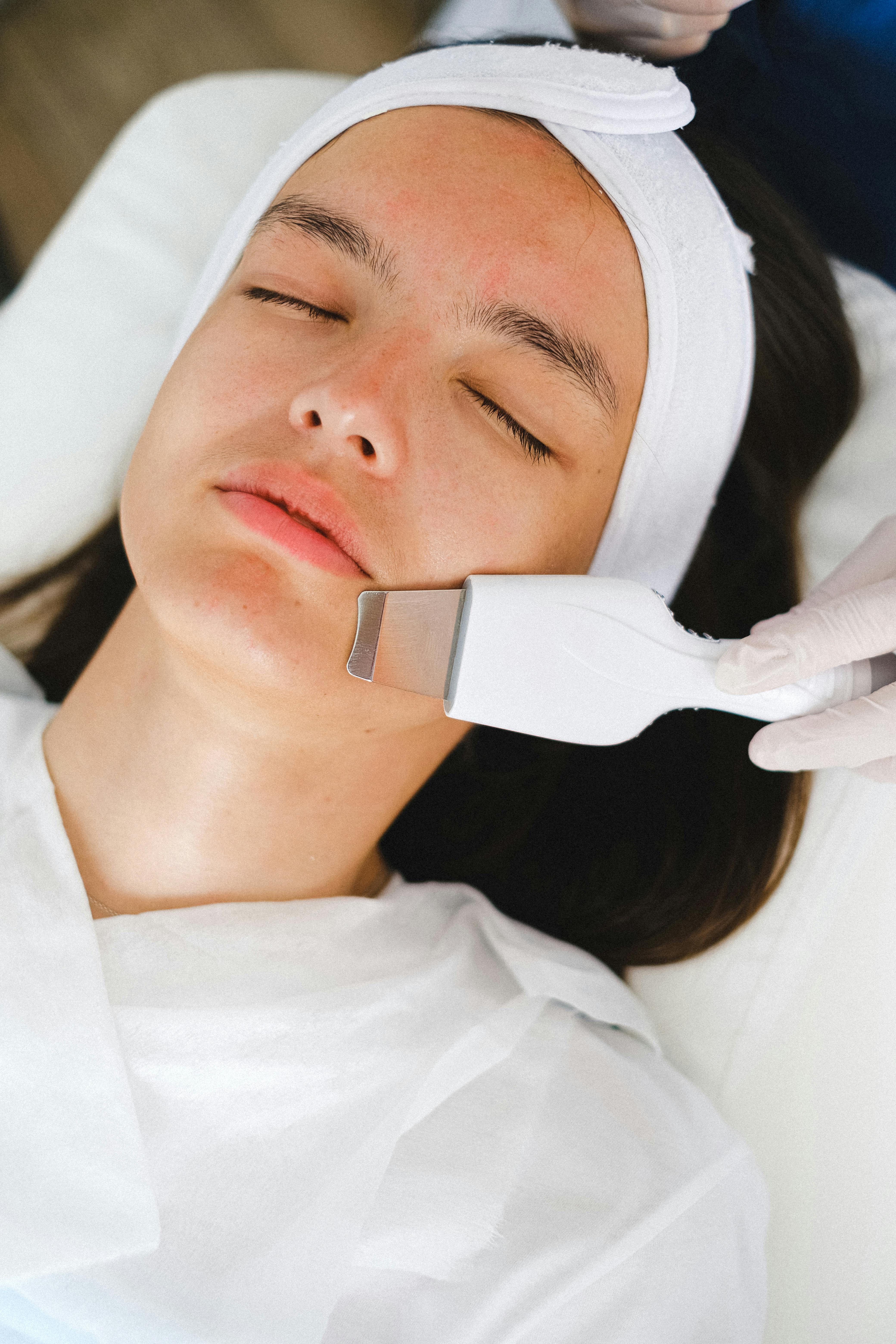 Tratamiento Dermaplaning